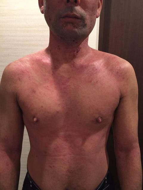 20151210体の状態77.6kg84cm.jpeg