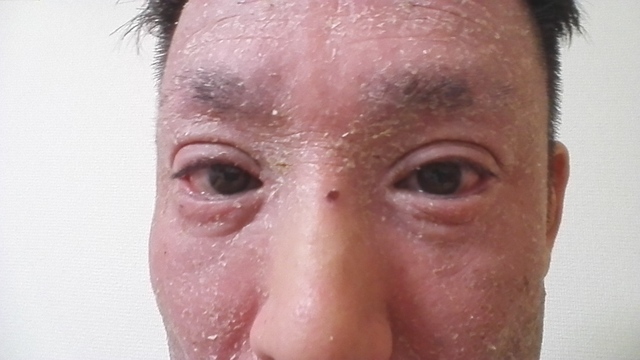 20160203顔上72.65kgW82.jpg